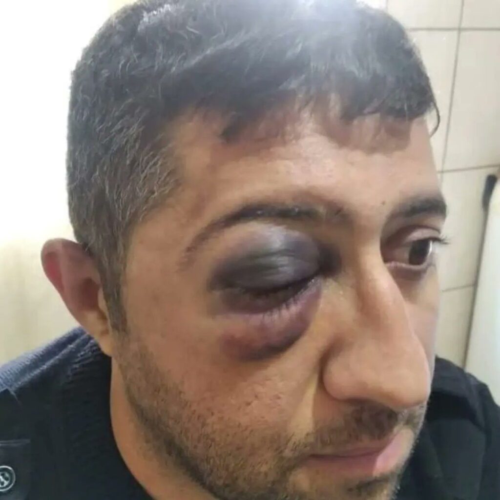 Mersin'de ''Siparişten Geç Gelen'' Kurye Öldüresiye Dövüldü